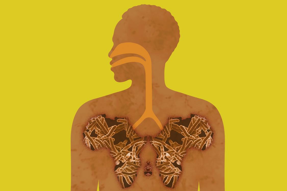 一个人的轮廓，他的肺形状就像充满结核细菌的非洲大陆